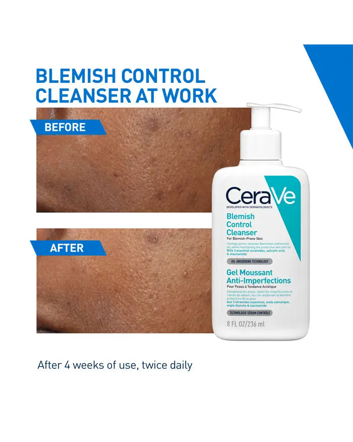 Cerave Blemish control Cleanser