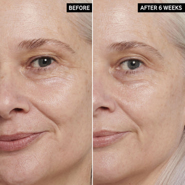 The Inkey List Retinol Eye Cream 15ml