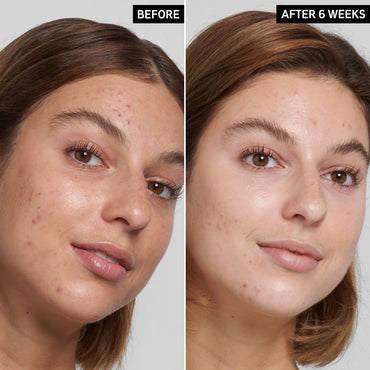 The Inkey List Salicylic Acid Cleanser 150ml