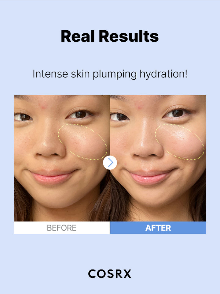Cosrx Hyaluronic Acid 3 Serum