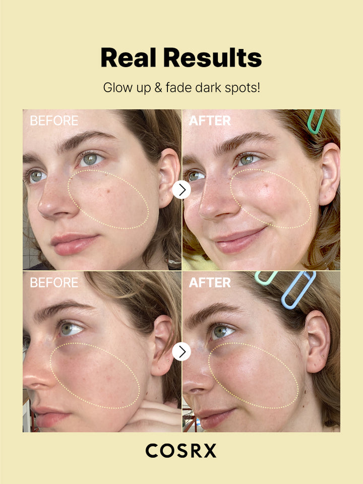 Cosrx Vitamin C 23 Serum