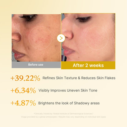 Medicube Kojic Acid Turmeric Resurfacing Toner benefits