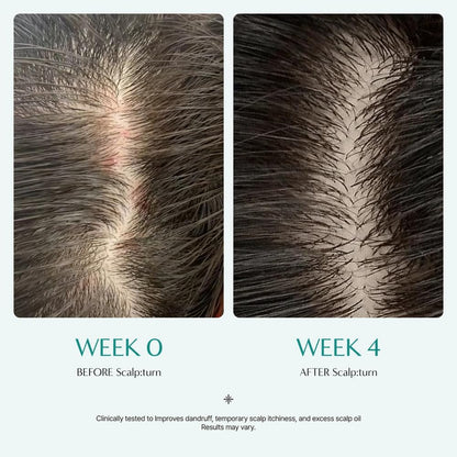 Lilyeve - Scalp Turn Cica PDRN Brush Ampoule 100Ml