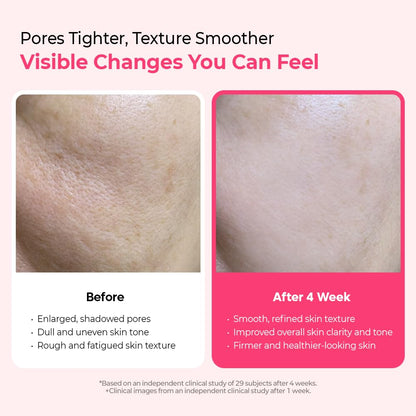 Dr.Melaxin - Cemenrete Cyano Pink Spicule Serum 30ml