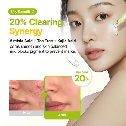 Purito SEOUL - Azelaic Acid 10 Kojic Tea Tree Serum - 30Ml