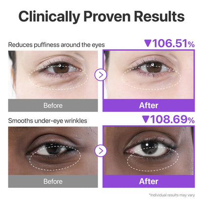 Numbuzin - No.9 NAD+ Collagen Under Eye Patches