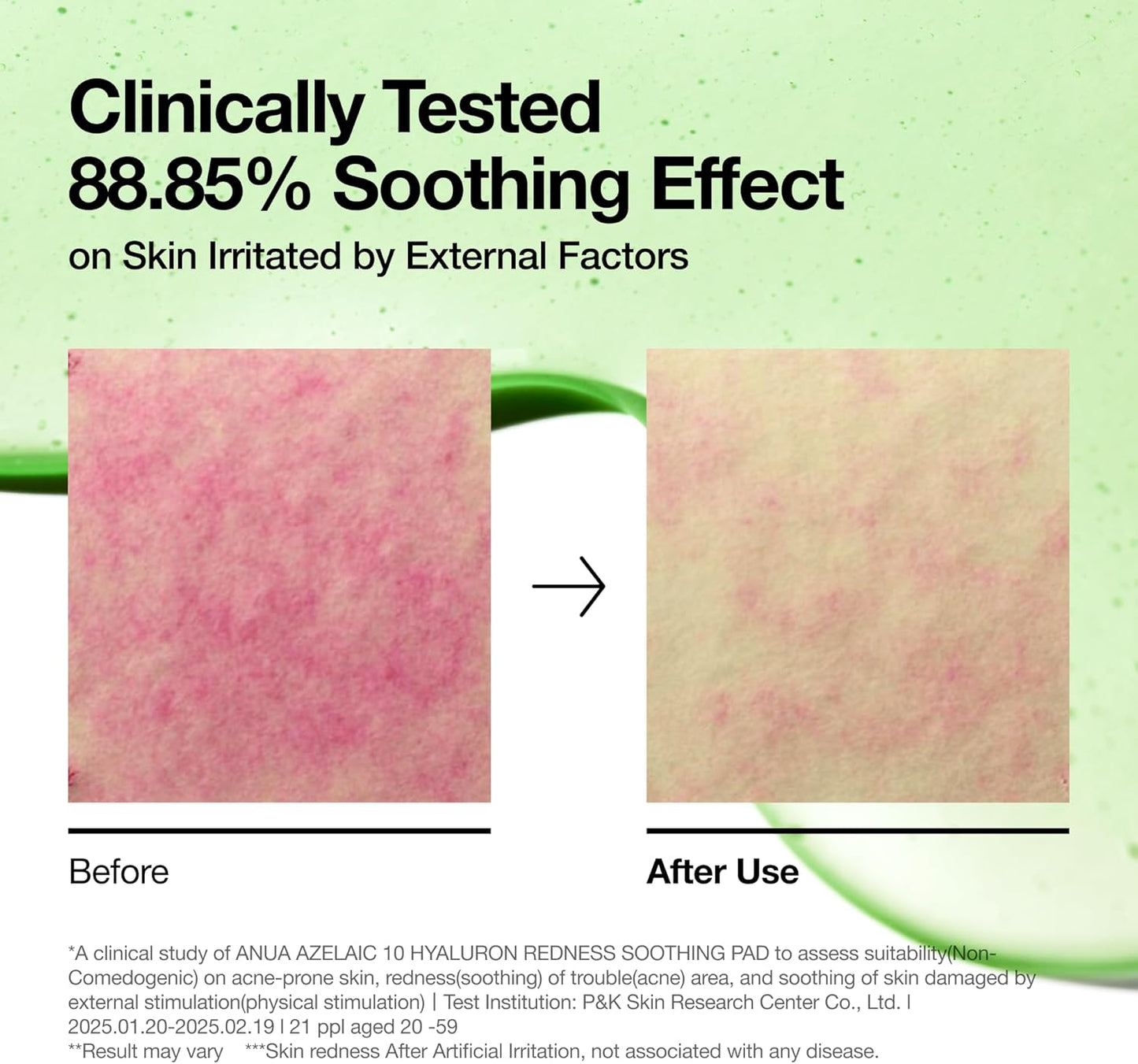 Azelaic 10 Hyaluron Redness Soothing Pad