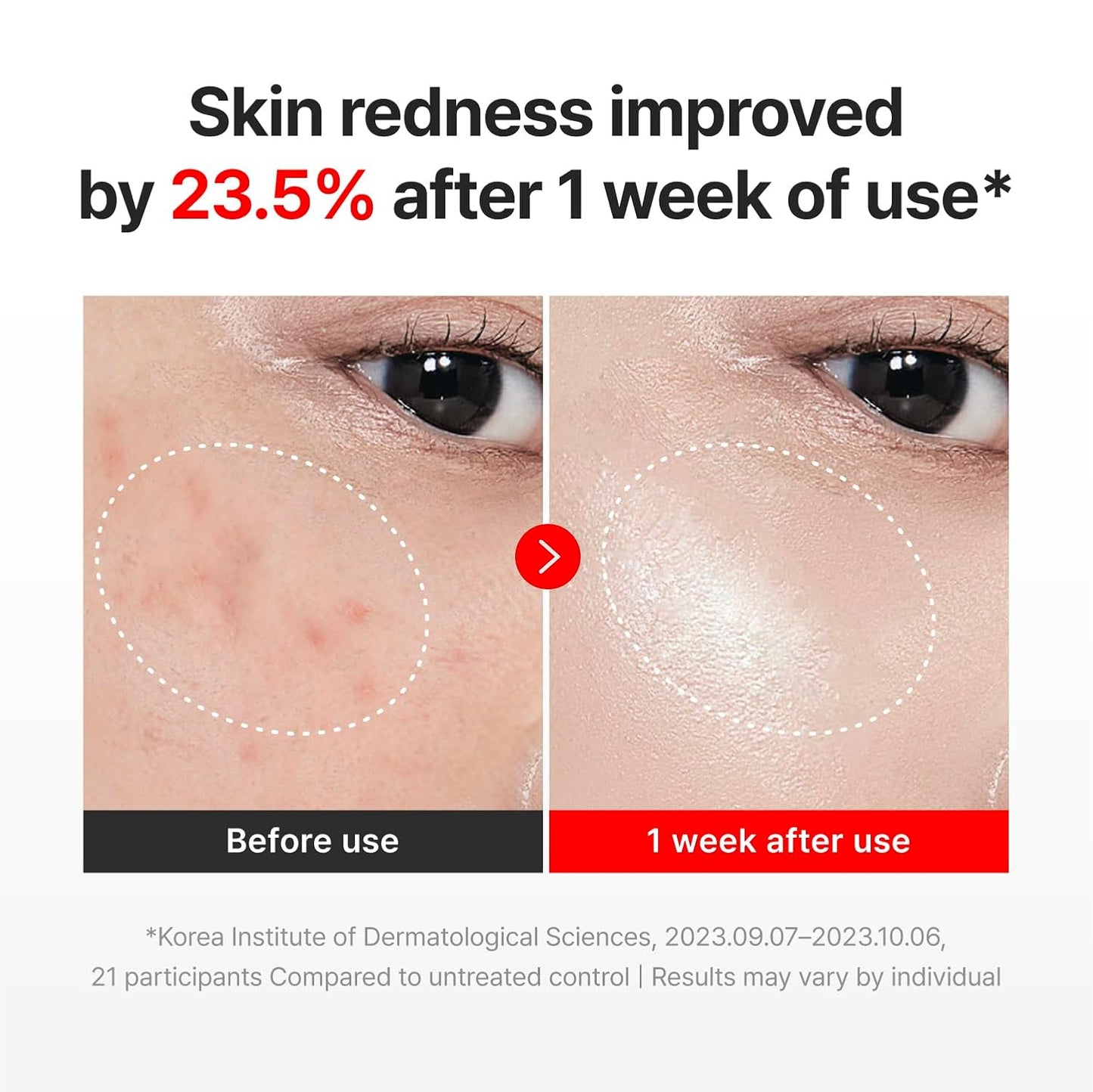 Centellian24 - Madeca Cream Time Reverse