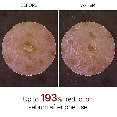 Dr.Melaxin - Peel Shot Exfoliating White Rice Ampoule - 80ml