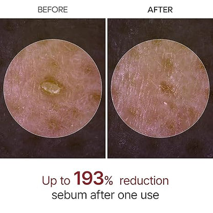 Dr.Melaxin - Peel Shot Exfoliating White Rice Ampoule - 80ml
