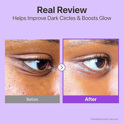 Numbuzin - No.9 NAD+ Retinol Volumetox Eye Cream - 10Ml