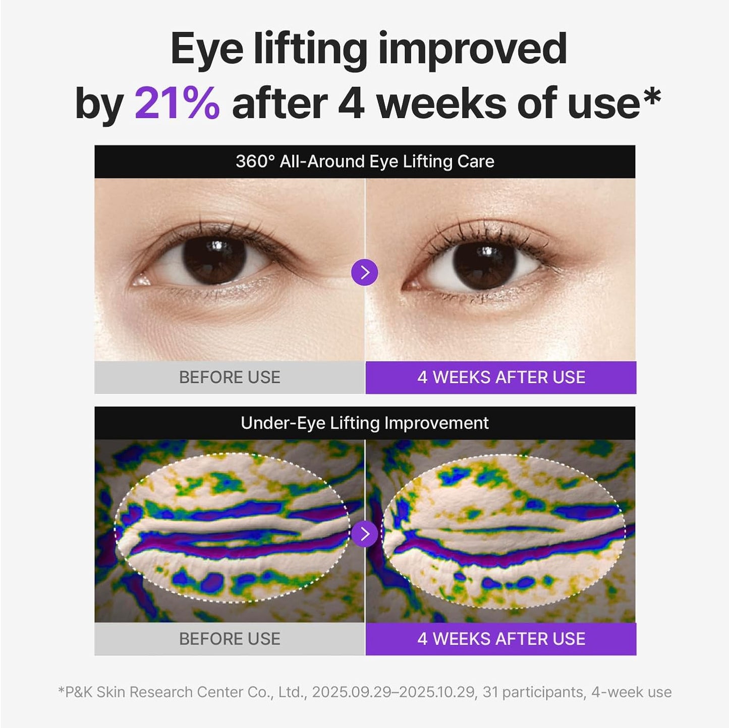 Centellian24 - 360º Shot PDRN Lifting Eye Cream - 30Ml