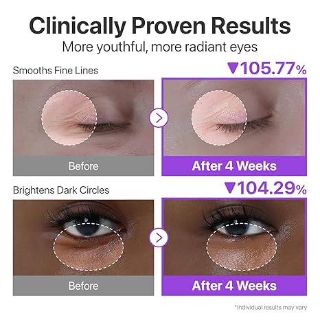 Numbuzin - No.9 NAD+ Retinol Volumetox Eye Cream - 10Ml