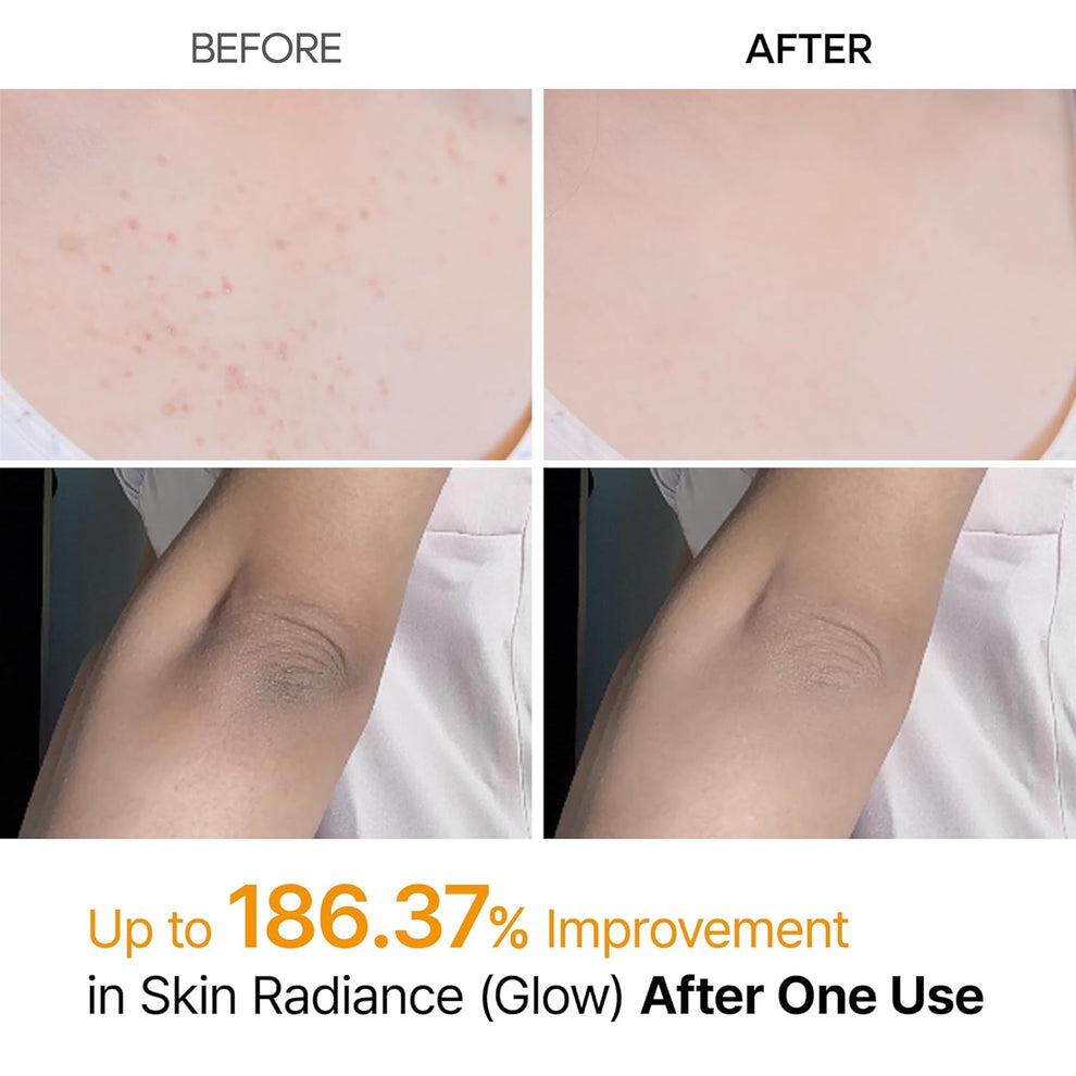 Dr.Melaxin - Peel Shot Exfoliating Kojic Acid Turmeric Spray Body and Foot Exfoliator - 200ml