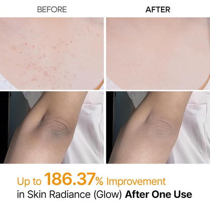 Dr.Melaxin - Peel Shot Exfoliating Kojic Acid Turmeric Spray Body and Foot Exfoliator - 200ml