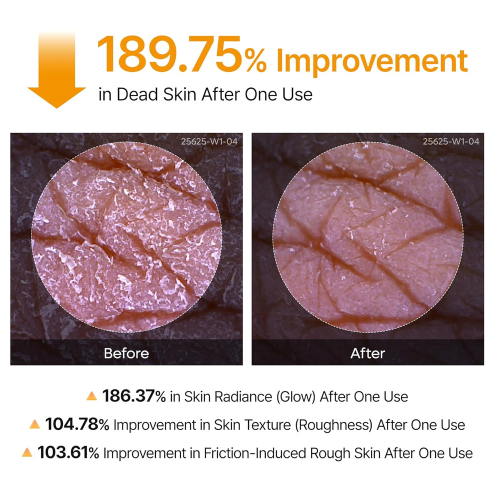 Dr.Melaxin - Peel Shot Exfoliating Kojic Acid Turmeric Spray Body and Foot Exfoliator - 200ml