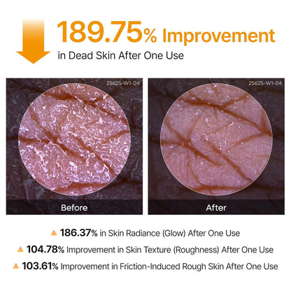 Dr.Melaxin - Peel Shot Exfoliating Kojic Acid Turmeric Spray Body and Foot Exfoliator - 200ml