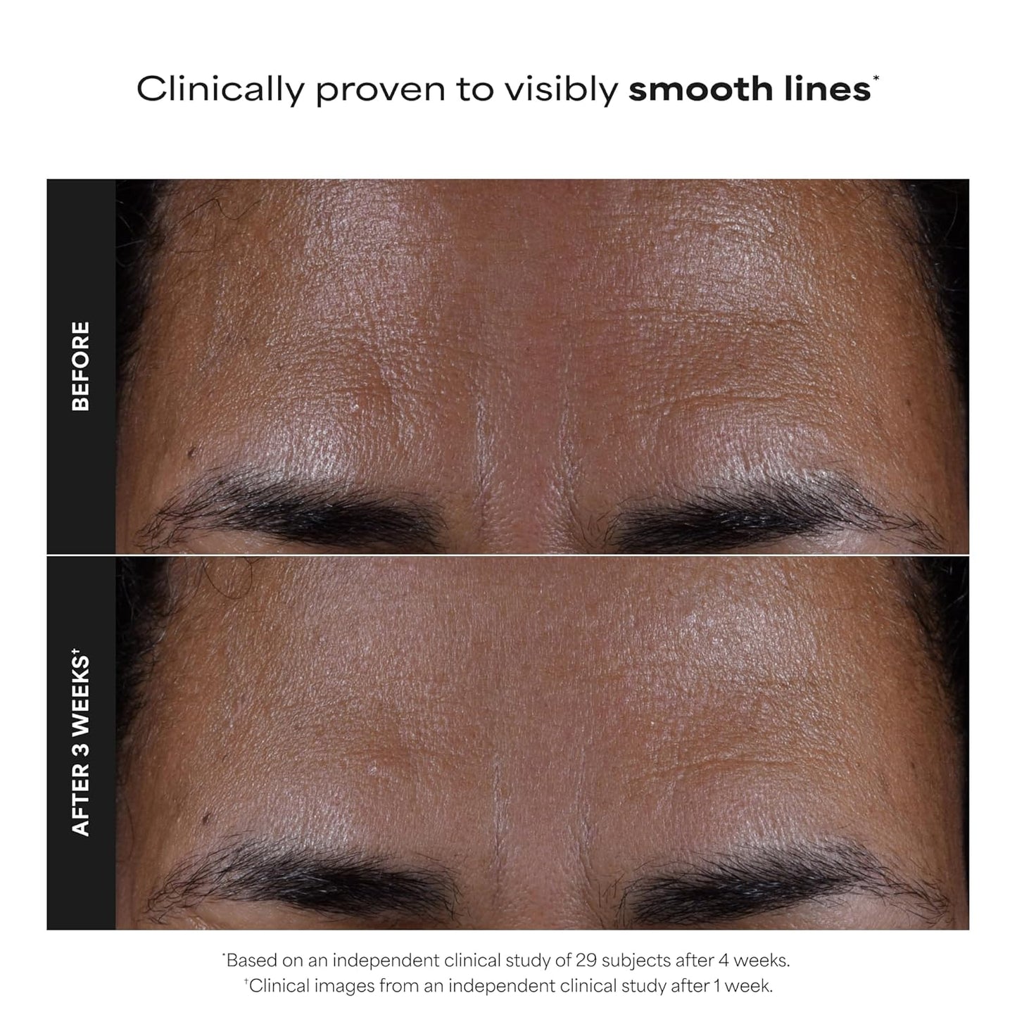 Paula's Choice Skin Perfecting 2% BHA Liquid Exfoliant - 30ml