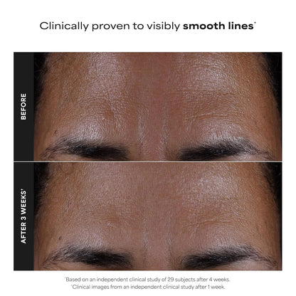 Paula's Choice Skin Perfecting 2% BHA Liquid Exfoliant - 30ml