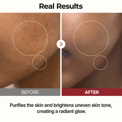 Dr.Melaxin - Peel Shot Glow White Rice Toner - 200ml