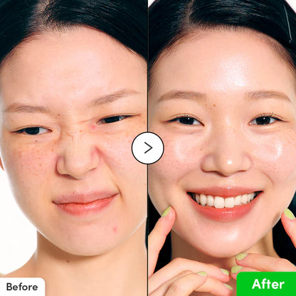 Aloe PDRN Calming Serum