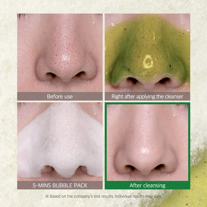 BYE BYE BLACKHEAD 30 DAYS MIRACLE GREEN TEA TOX BUBBLE CLEANSER