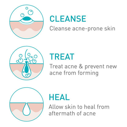 Acne Foaming Cleanser